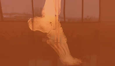 Reflection of the office on a screen showing a foot x-ray